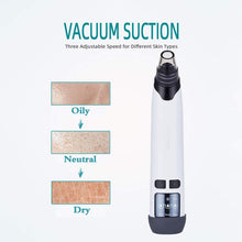 Load image into Gallery viewer, Rechargeable Electric Vacuum Blackhead Remover Cleanser with 4 Replaceable Heads