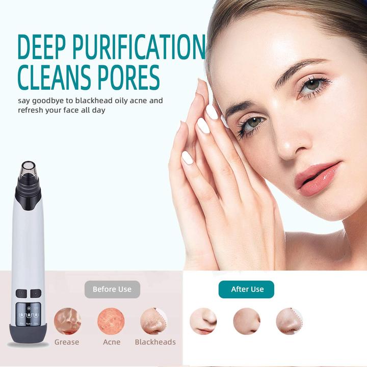 Rechargeable Electric Vacuum Blackhead Remover Cleanser with 4 Replaceable Heads