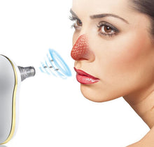 Load image into Gallery viewer, 5 in 1 Face nose porblackhead remover