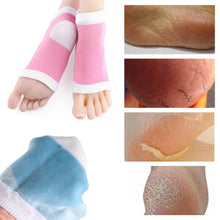 Load image into Gallery viewer, Moisturizing Gel Heel Socks for Dry/Cracked/Peeling Heels