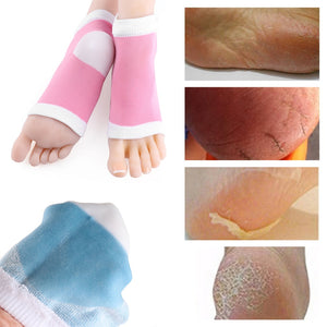 Moisturizing Gel Heel Socks for Dry/Cracked/Peeling Heels